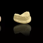 Rodzaje i zastosowanie gipsu dentystycznego w pracowni protetycznej