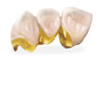 złoto dentystyczne